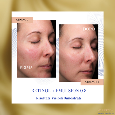  siero Retinol + iS Clinical su sfondo post 